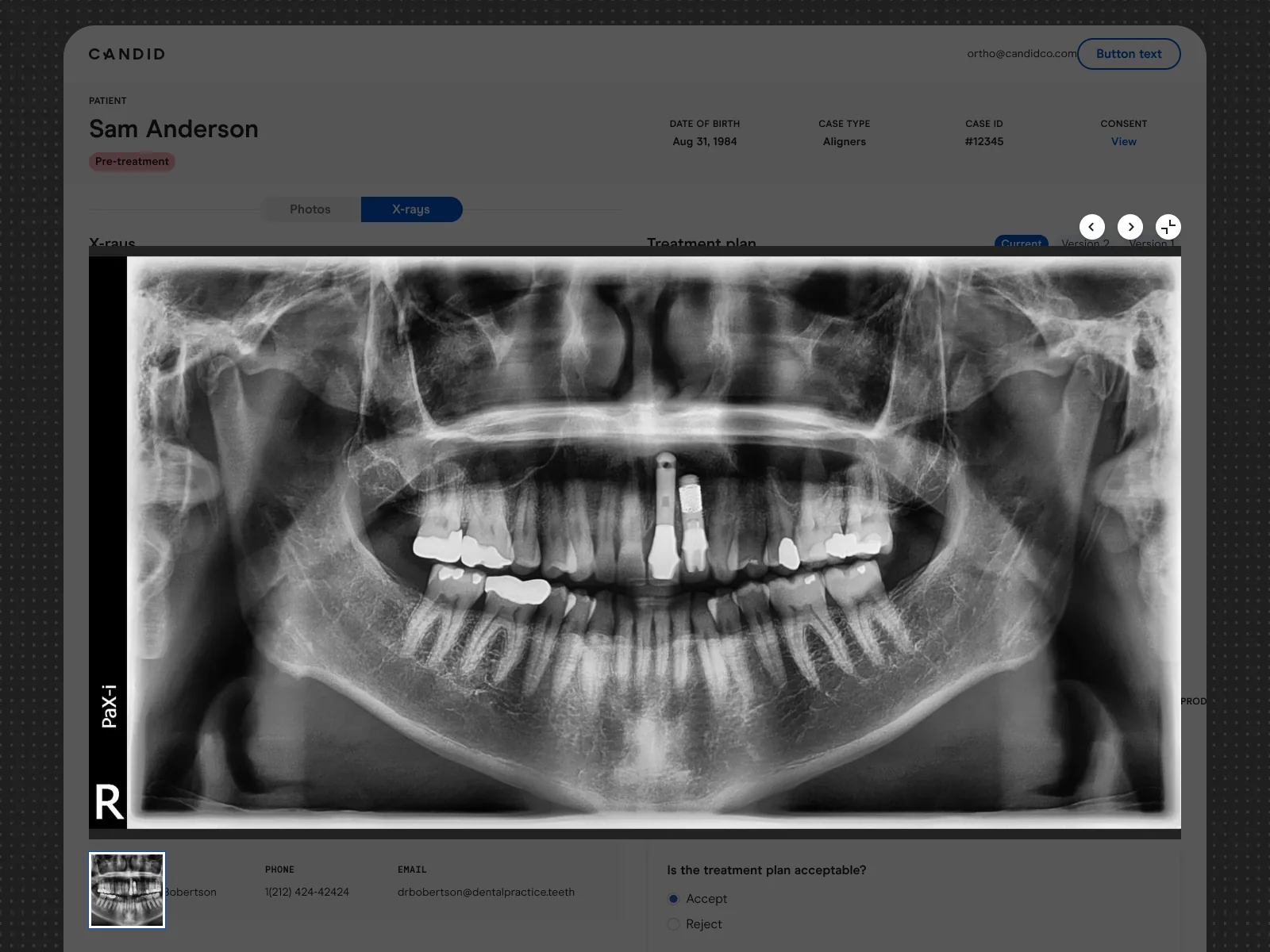Panoramic dental X-ray enlarged in the provider portal